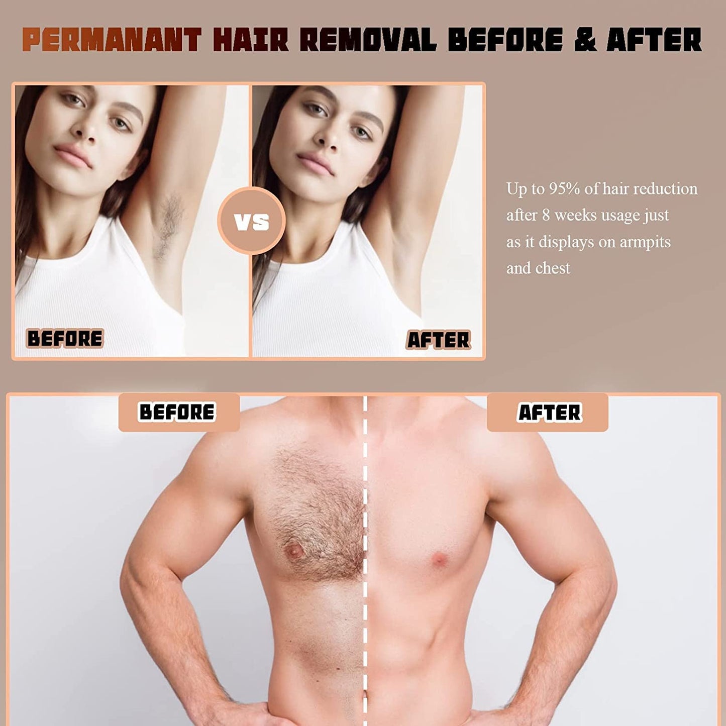 At Home Laser Hair Removal Device for Permanent Hair Reduction
