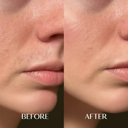 The Facial Hair Serum | 1+1 FREE
