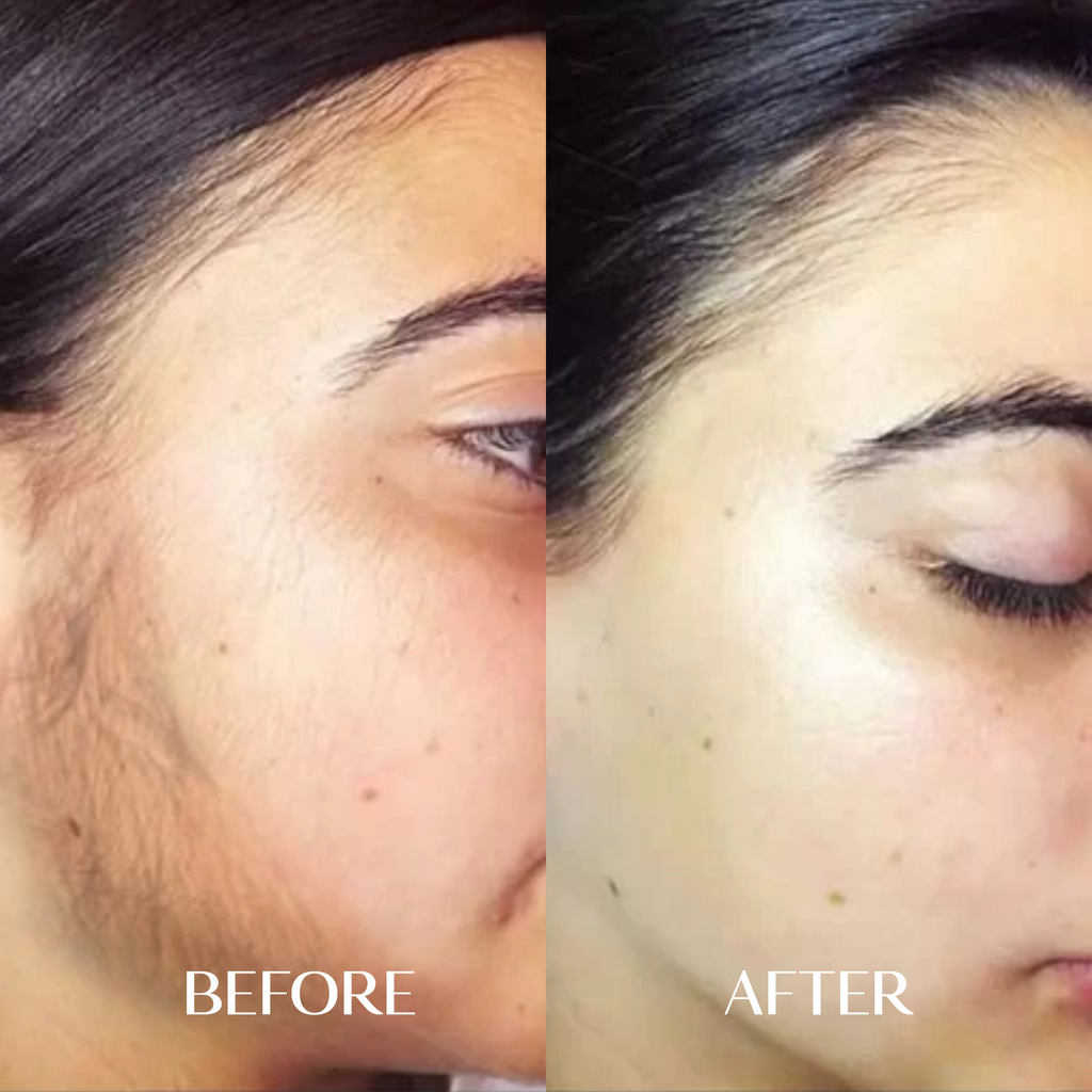 The Facial Hair Serum | 1+1 FREE