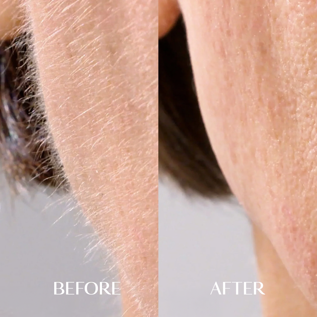 The Facial Hair Serum | 1+1 FREE