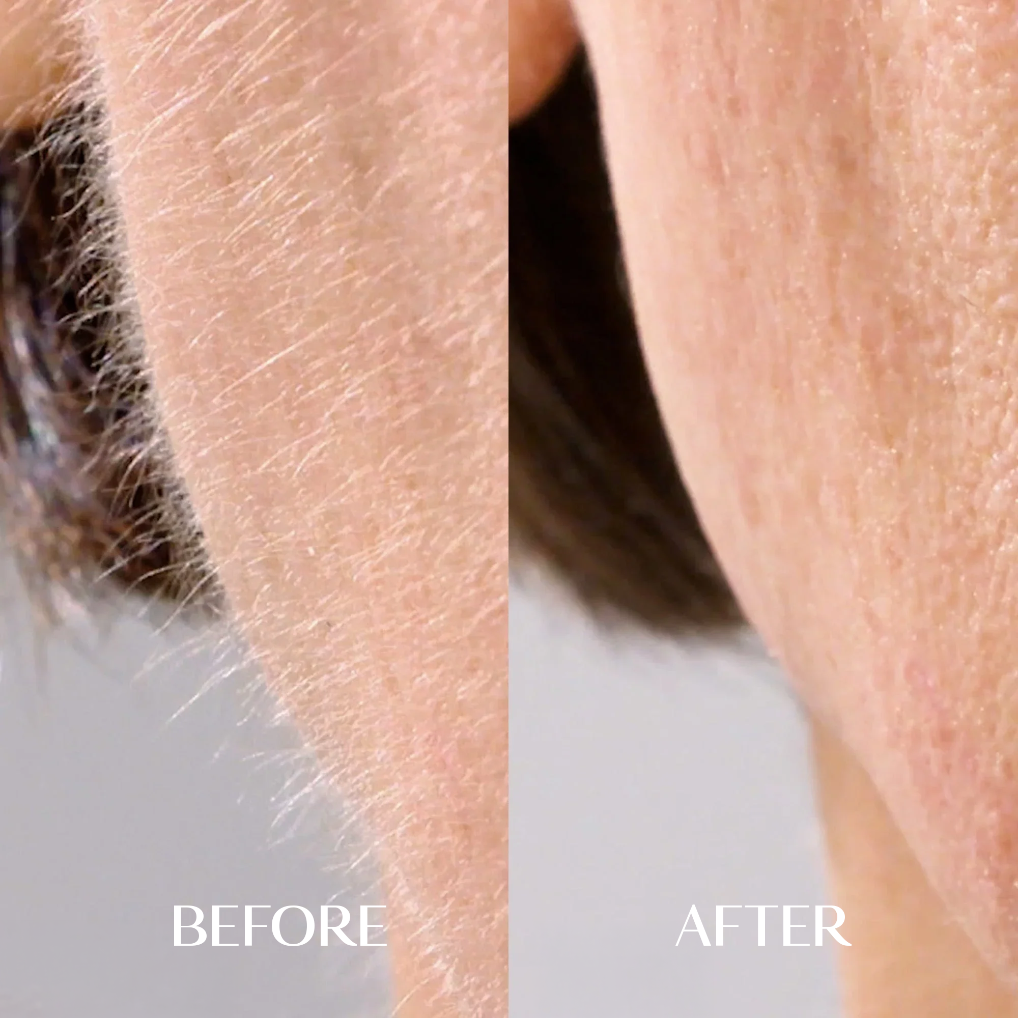 The Facial Hair Serum | 1+1 FREE