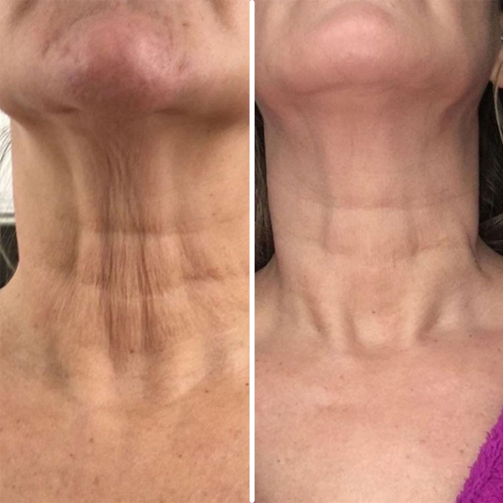 Age-Defying Neck Lift & Firm Cream