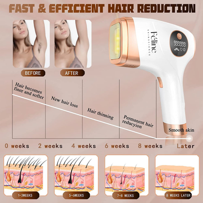 At Home Laser Hair Removal Device for Permanent Hair Reduction