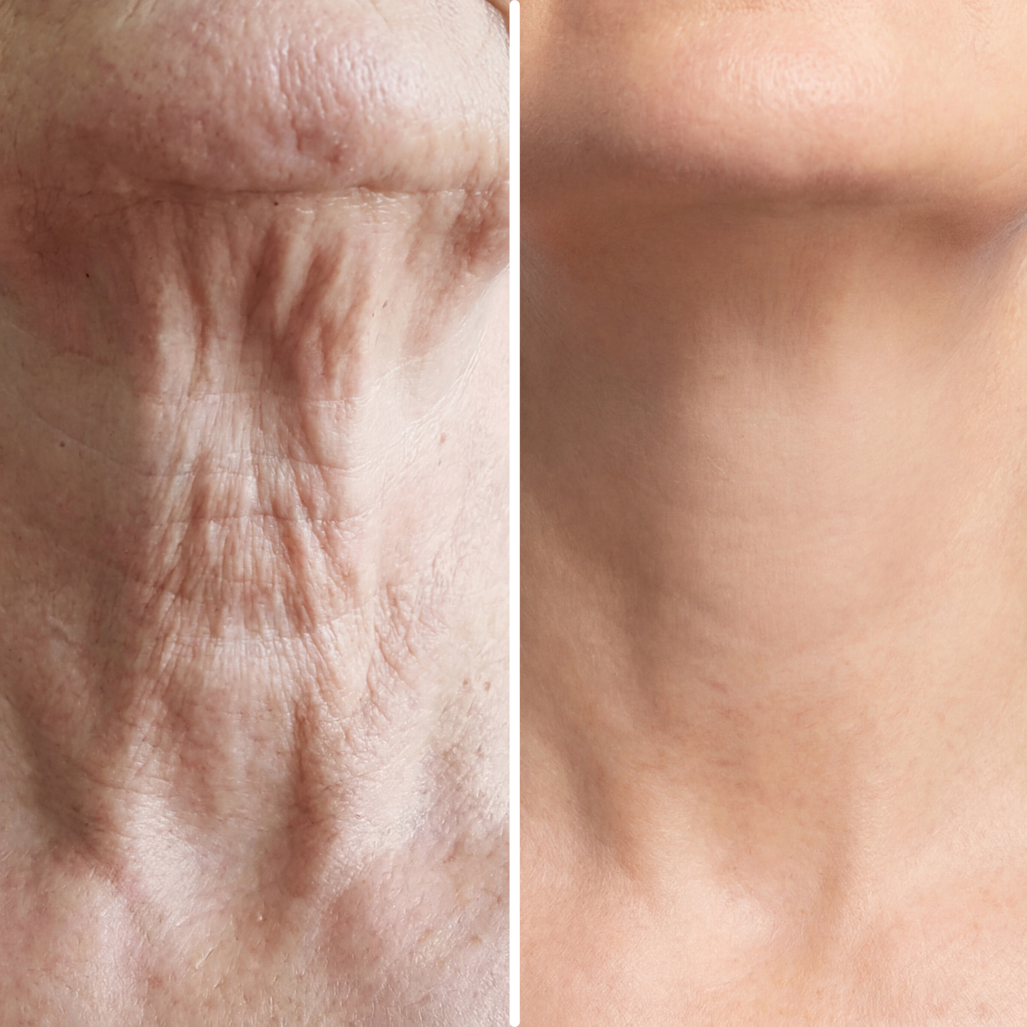 Age-Defying Neck Lift & Firm Cream | 1+1 FREE