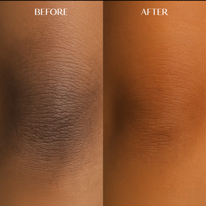 Melanin Dark Spot Corrector | 1+1 FREE