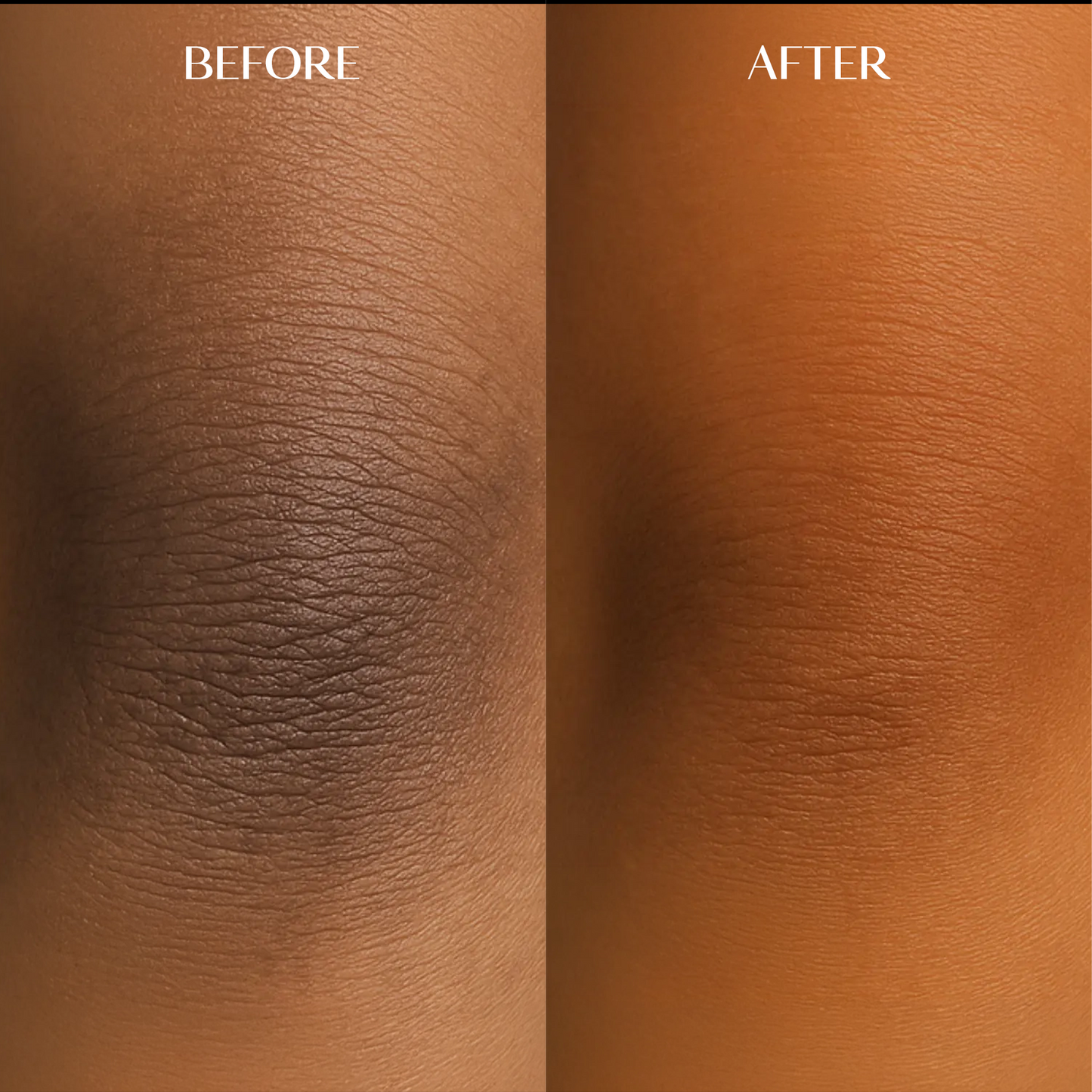 Body Brightening Corrector | 1+1 FREE