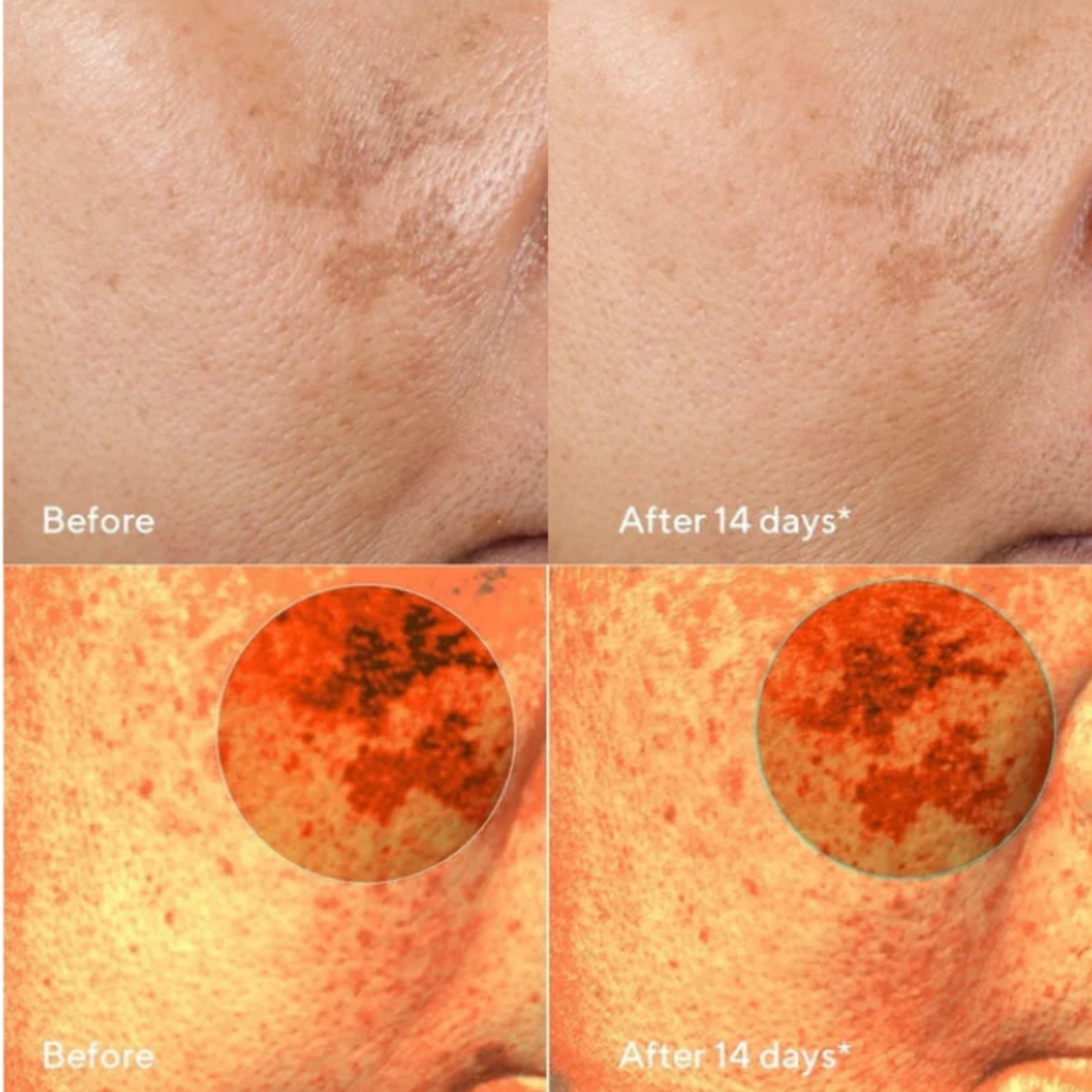 Dark Spot Corrector with Tyrosinase Inhibitors, Niacinamide, Resveratrol, Vitamin C, Kojic Acid