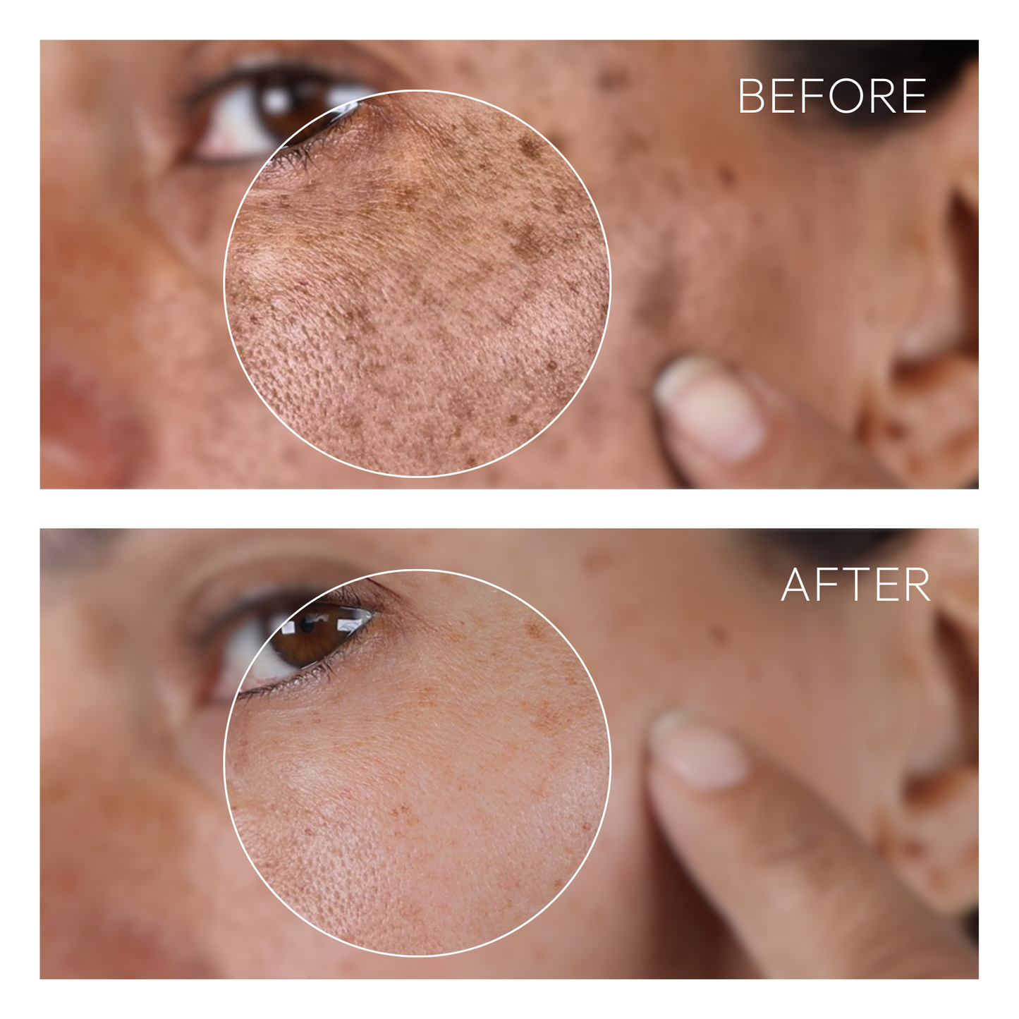 The Complete Dark Spot Solution | Erase & Block
