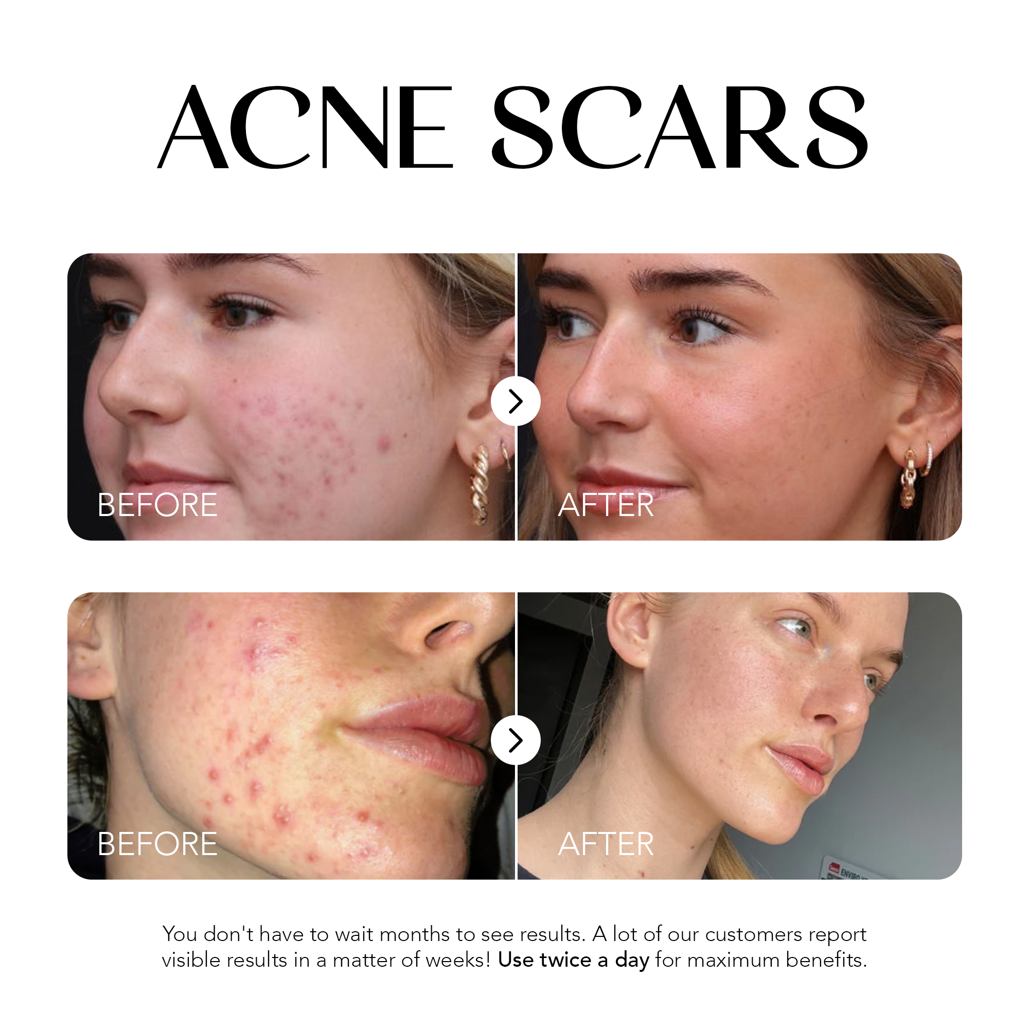 Dark Spot Corrector | 1+1 FREE