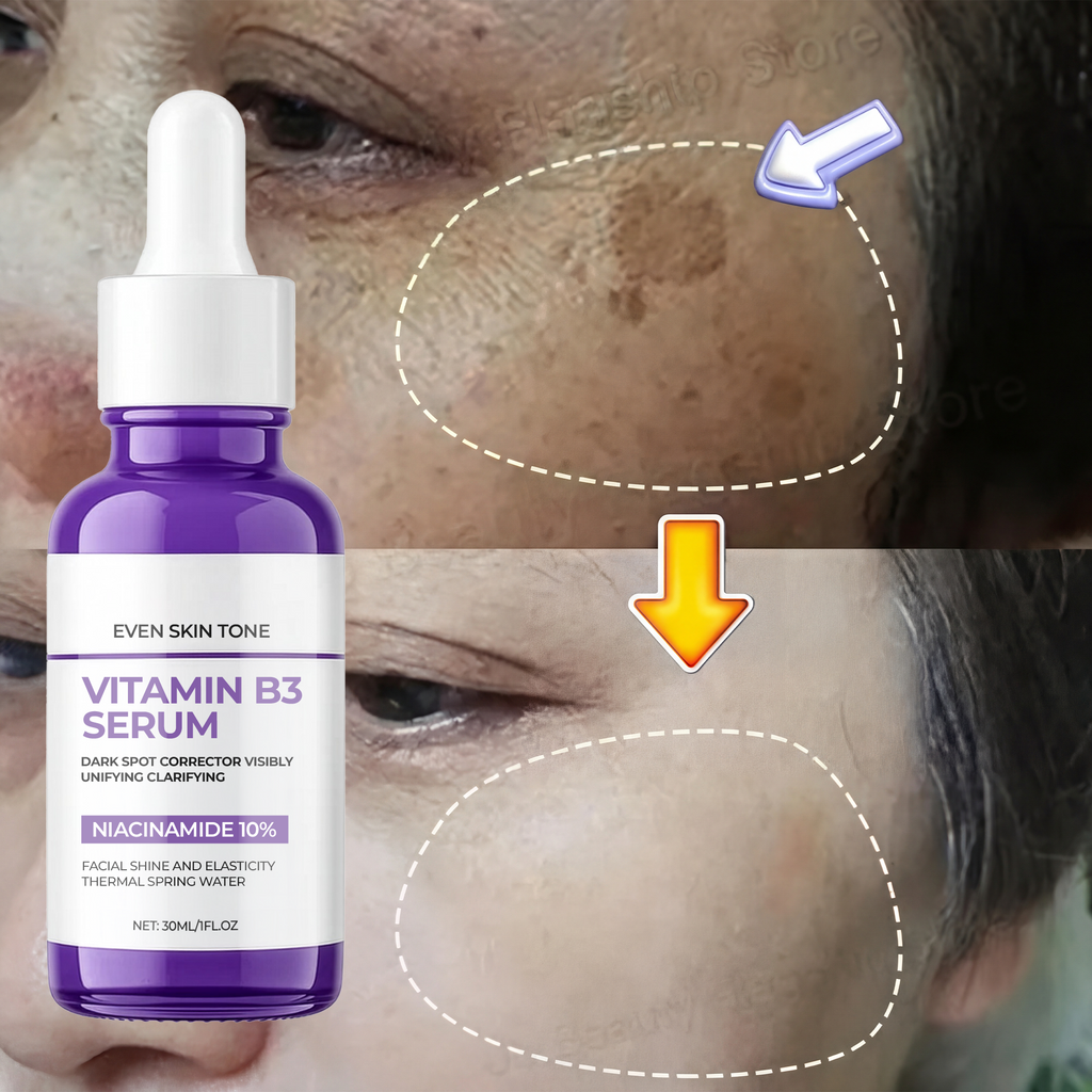 Dark Spot Corrector Serum for Hyperpigmentation & Melasma