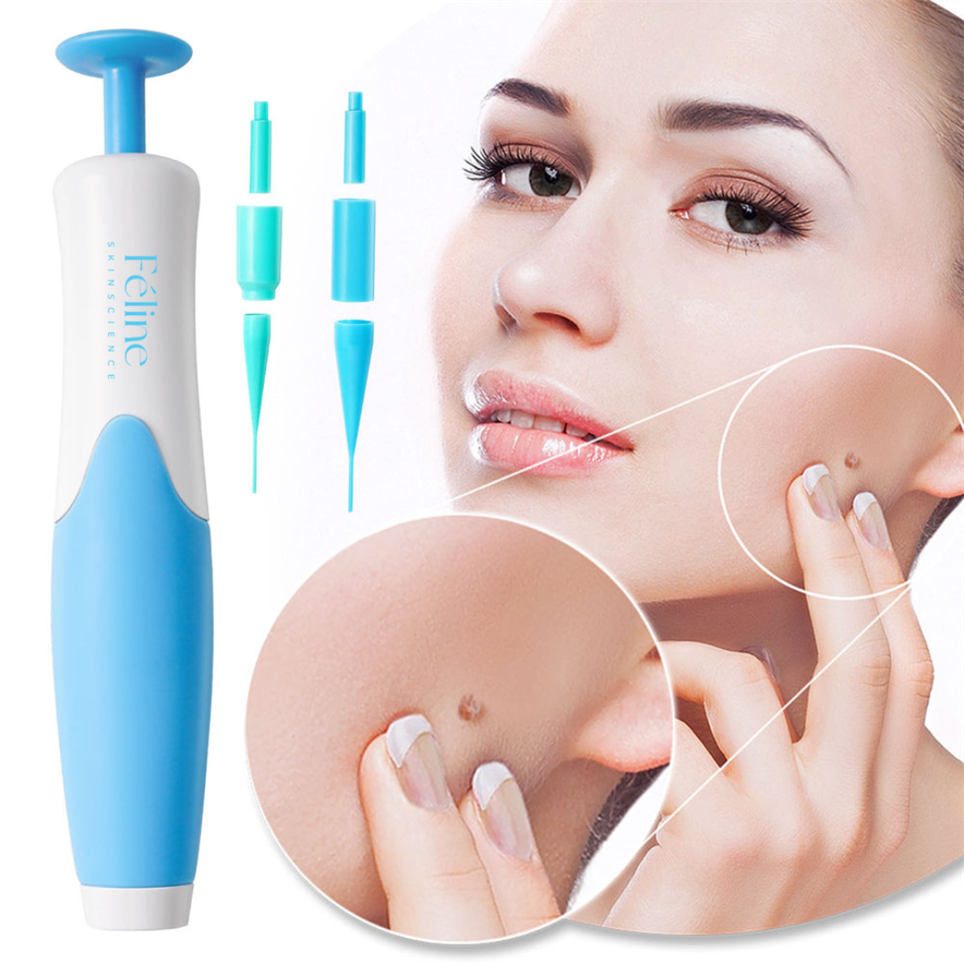 Skin Tag & Mole Remover Pen for Safe Removal at Home