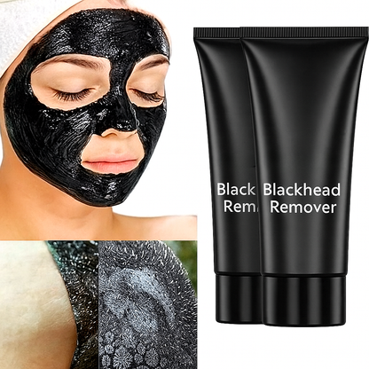 Charcoal Blackhead Mask for Deep Pore Cleansing & Acne