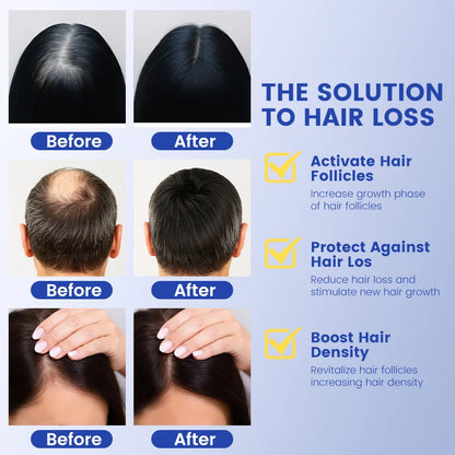 Hair Regrowth Serum for Thinning Hair & Scalp Health