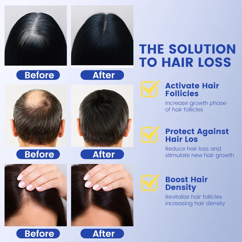 Copper Peptide Hair Growth Serum for Hair Loss & Thinning Hair