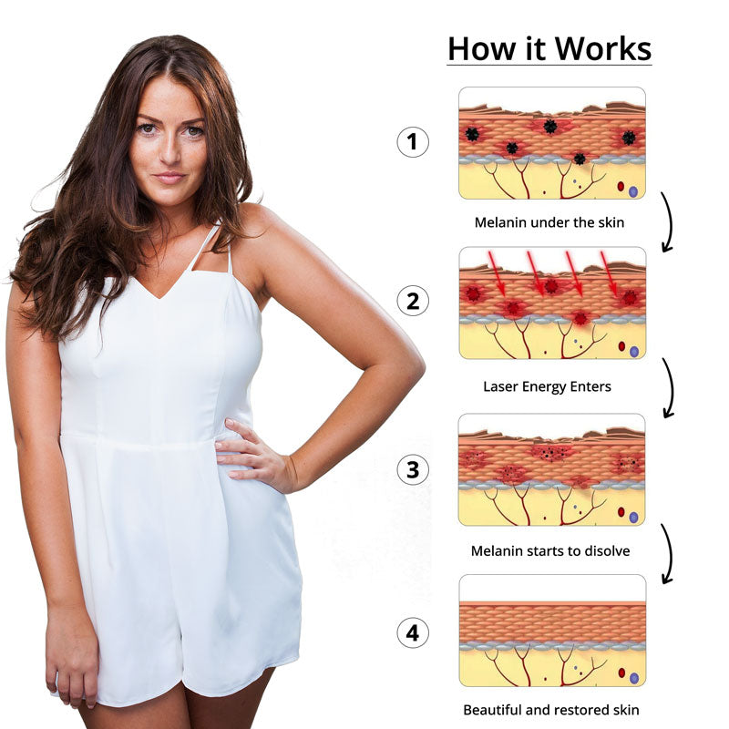 Laser Tattoo Removal Pen for Pigment Removal & Skin Correction