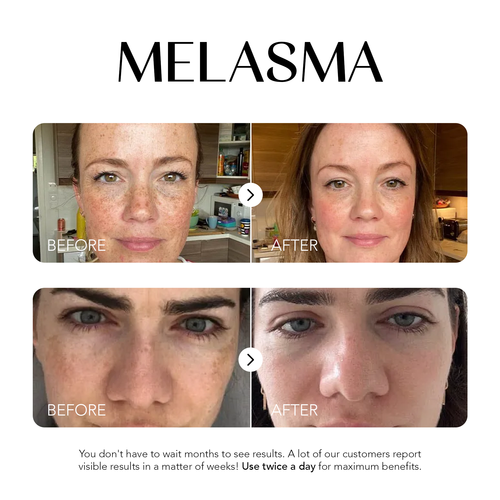 Dark Spot Corrector | 1+1 FREE