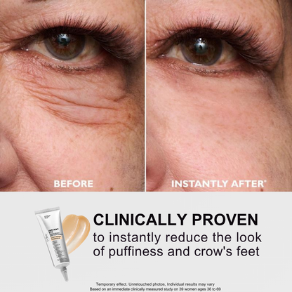 Instant Eye Tightening Cream for Wrinkles & Fine Lines