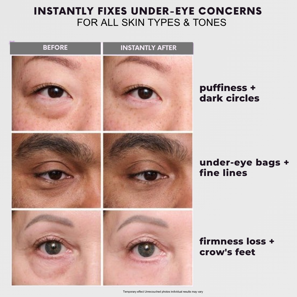 Instant Eye Tightening Cream for Wrinkles & Fine Lines