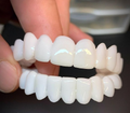 Fake Teeth for Missing Teeth | Easy At-Home Smile Solution