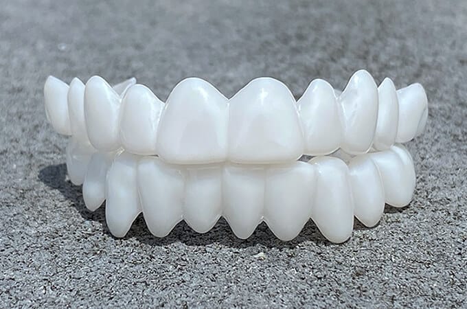 Snap-On Veneers for Missing Teeth | Instant Smile Fix