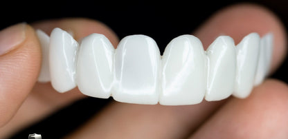 Dental Prosthetics for Missing Teeth & Smile Restoration