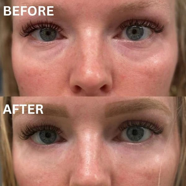 InstantFirm Eye Patches
