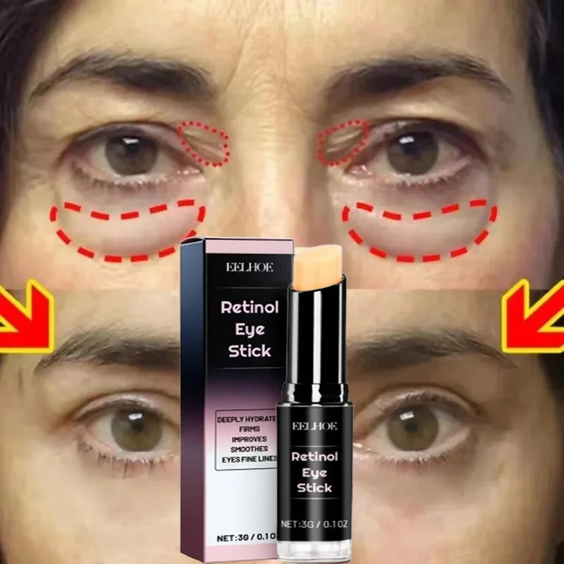 Eye Bag Removal Stick for Puffiness, Wrinkles & Dark Circles