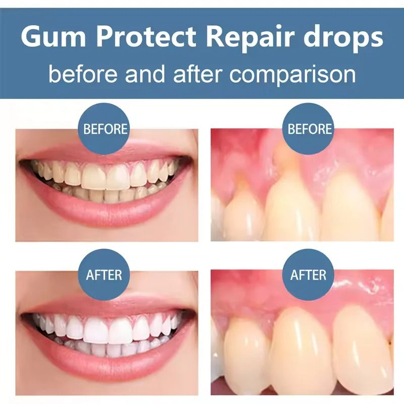 Gum Repair Gel for Bleeding Gums & Tartar Removal