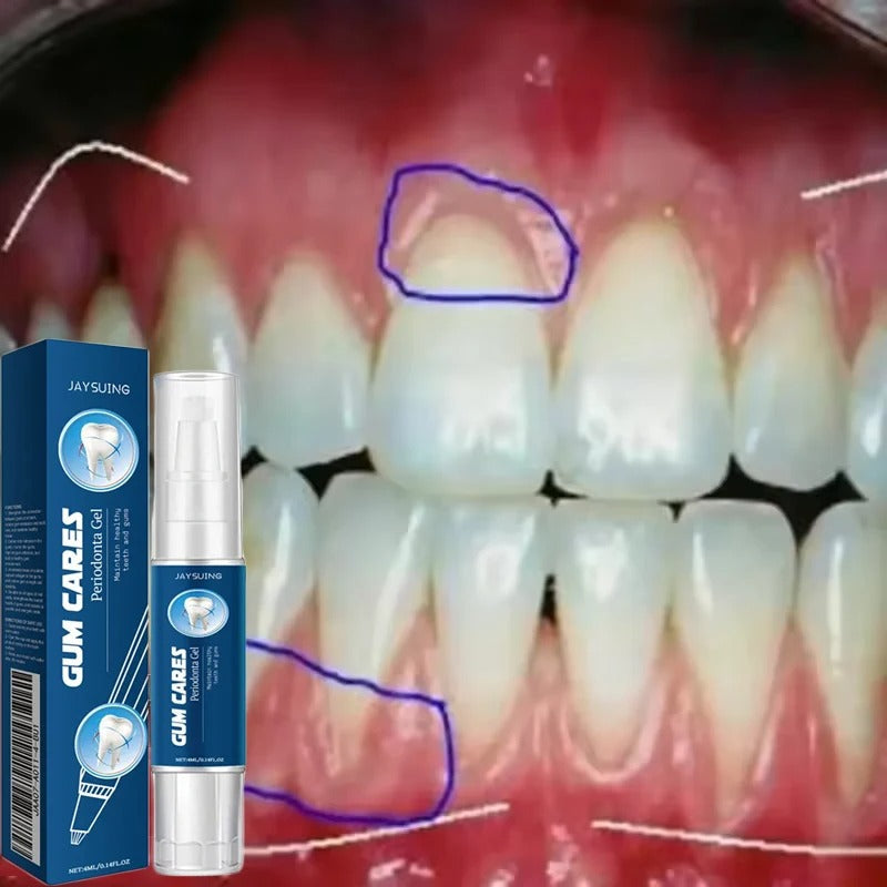 Gum Repair Gel for Bleeding Gums & Tartar Removal