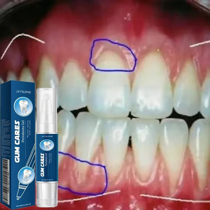 Gum Repair Gel for Bleeding Gums & Tartar Removal