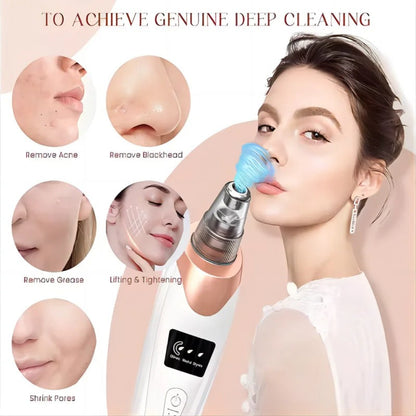 Blackhead Remover Vacuum for Deep Pore Cleaning & Acne Removal