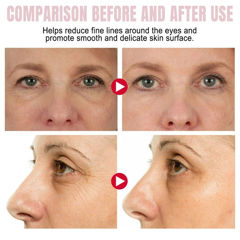 Eye Bag Removal Stick for Puffiness, Wrinkles & Dark Circles