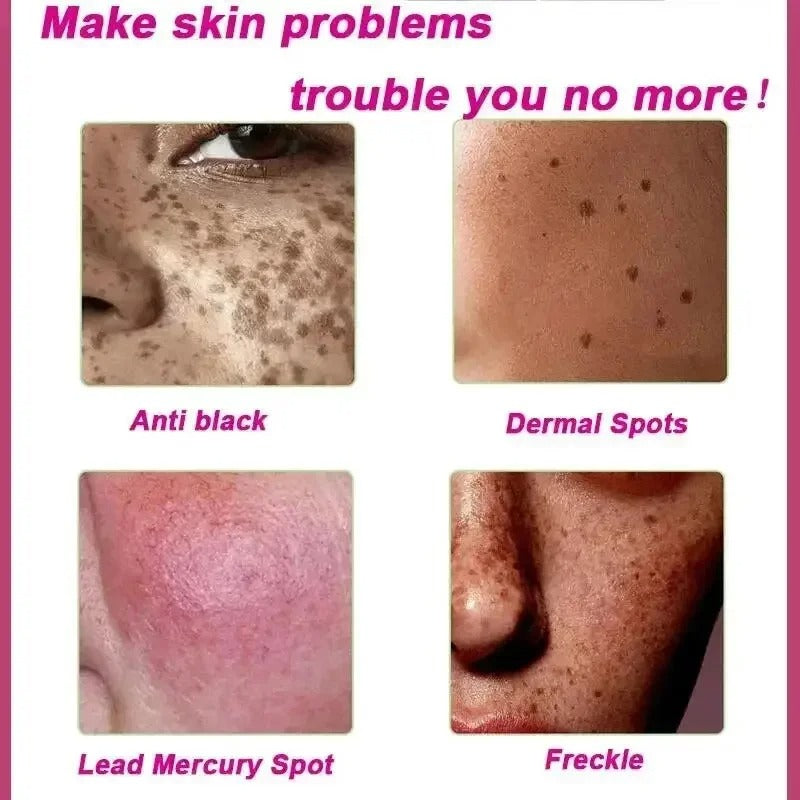 Dark Spot Corrector Serum for Hyperpigmentation & Melasma