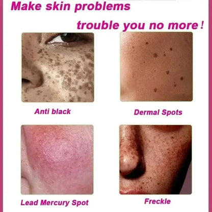 Dark Spot Corrector Serum for Hyperpigmentation & Melasma