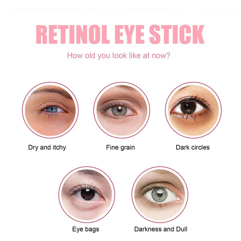 Eye Bag Removal Stick for Puffiness, Wrinkles & Dark Circles