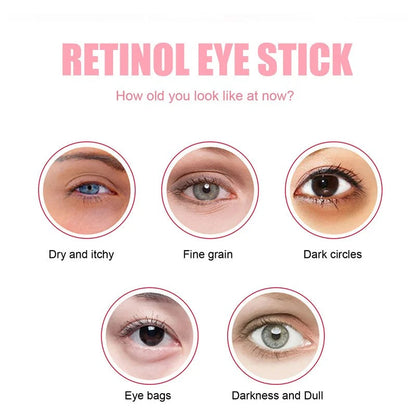 Eye Bag Removal Stick for Puffiness, Wrinkles & Dark Circles