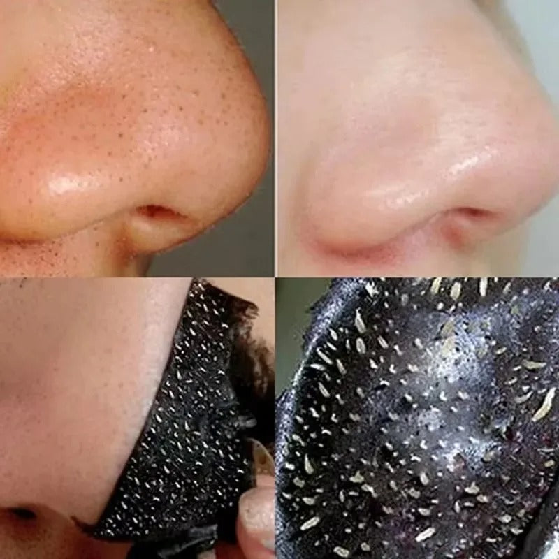 Charcoal Blackhead Mask for Deep Pore Cleansing & Acne