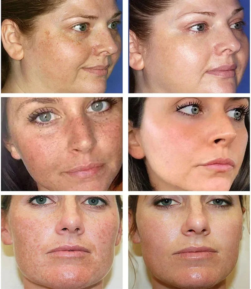 Dark Spot Corrector Serum for Hyperpigmentation & Melasma