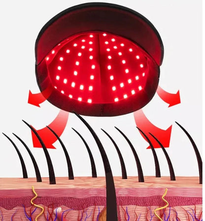 Red Light Therapy Hair Growth Cap for Hair Loss & Thinning Hair