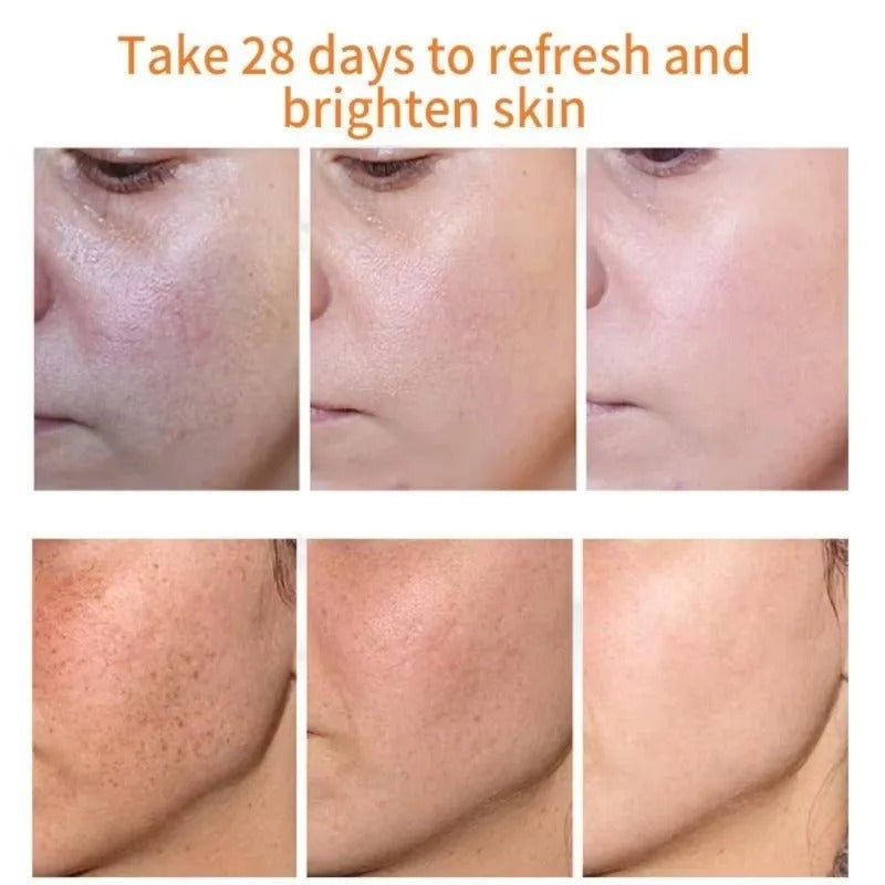 Dark Spot Corrector Serum for Hyperpigmentation & Melasma