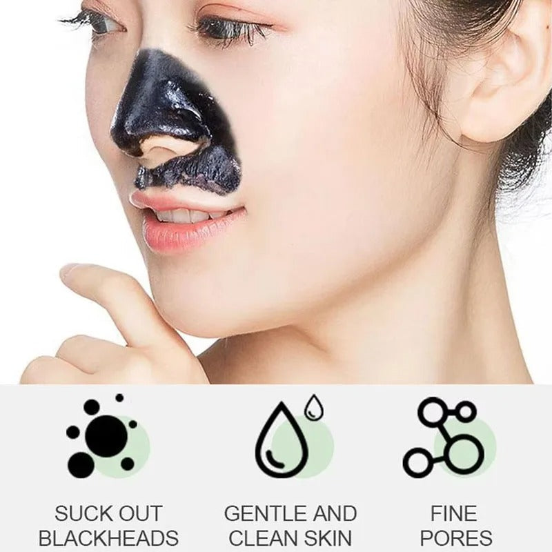 Charcoal Blackhead Mask for Deep Pore Cleansing & Acne