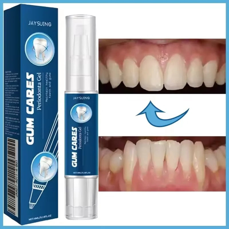 Gum Repair Gel for Bleeding Gums & Tartar Removal