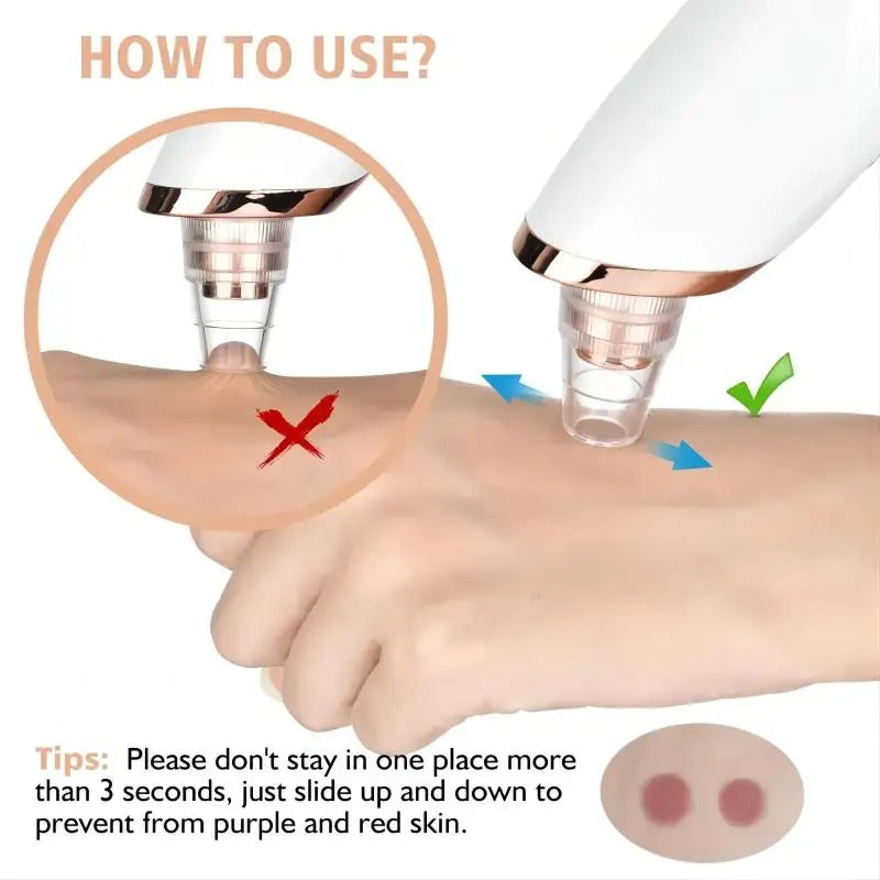 Blackhead Remover Vacuum for Deep Pore Cleaning & Acne Removal