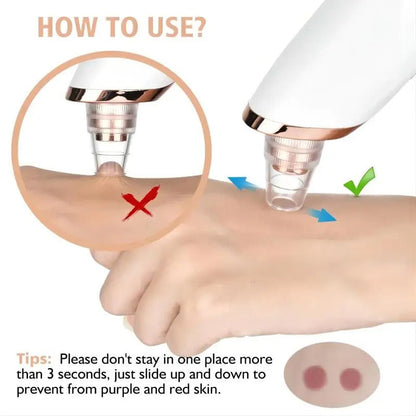 Blackhead Remover Vacuum for Deep Pore Cleaning & Acne Removal
