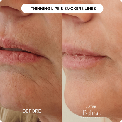 Anti-Wrinkle & Fine Line Cream | 1+1 FREE