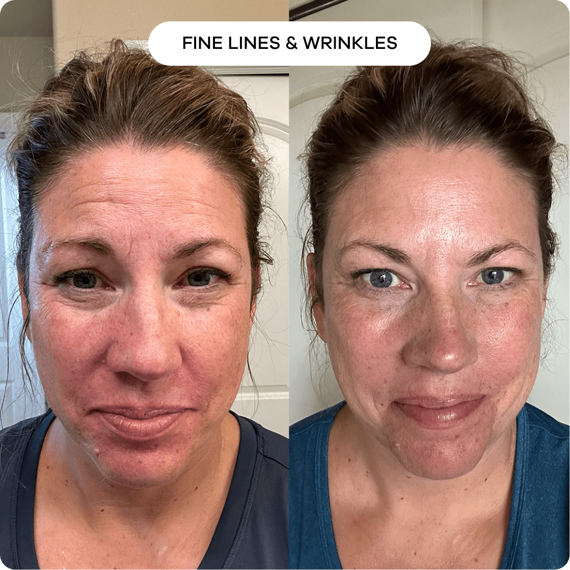 Anti-Wrinkle & Fine Line Cream | 1+1 FREE