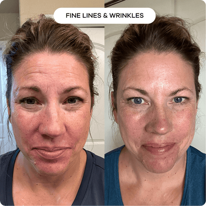 Anti-Wrinkle & Fine Line Cream | 1+1 FREE